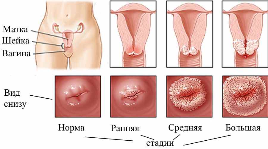 Ректальные свечи с метилурацилом. Применение метилурациловых свечей.